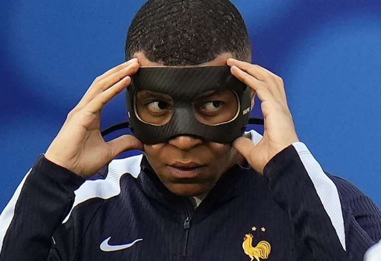 Mabppé con la máscara que protege su nariz. Foto: Internet